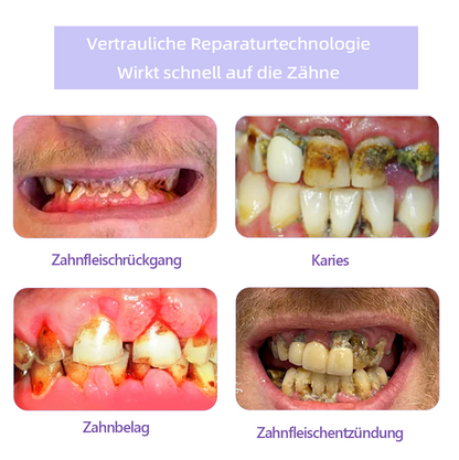 Oyikey™ Zahnreparatur-Mineralpuder👨‍⚕️(Empfohlen von der Bundeszahnärztekammer)💥